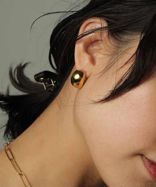 金属アレルギーを起こしにくいサージカルステンレス素材